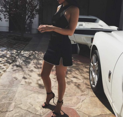 La gran cicatriz de Kylie Jenner