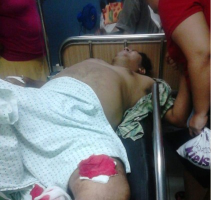 Asaltan y hieren a camarógrafo en La Ceiba