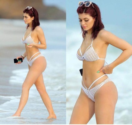 La gran cicatriz de Kylie Jenner