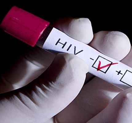 Sale a la venta la primera prueba casera para detectar Sida