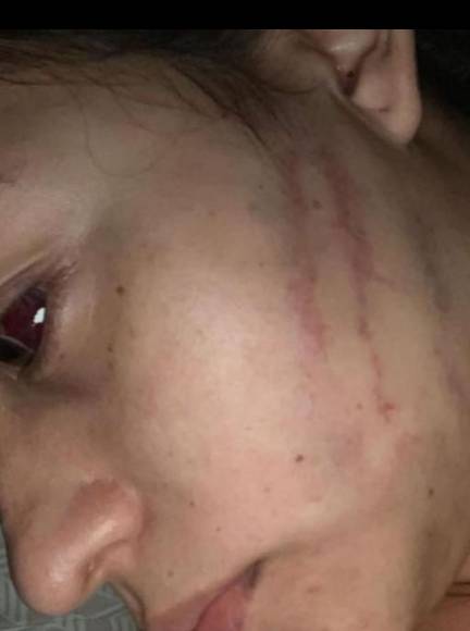 Un hombre la golpeó, maltrató y hasta mató a su madre: los abusos sufridos por la hondureña Lisbany León