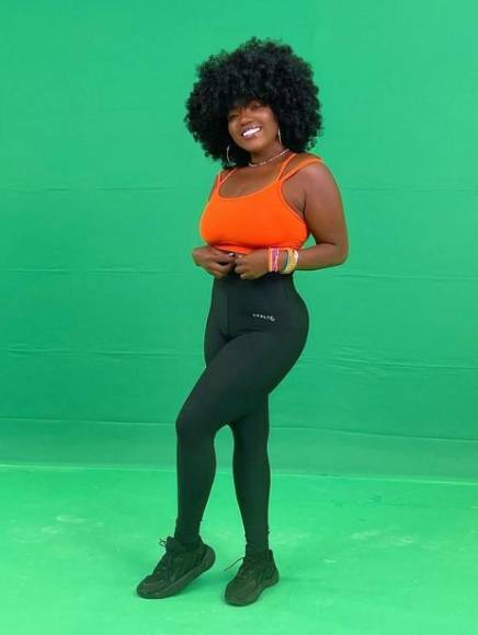 El increíble cambio físico de la Chiky Bombom tras someterse a bypass gástrico