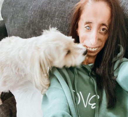 La inspiradora historia detrás de Lizzie Velásquez, la 'mujer más fea del mundo'