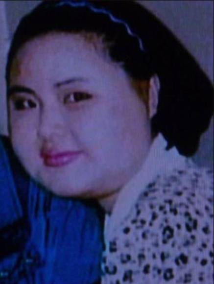 Exmodelo coreana se inyectó aceite de cocina en la cara y destruyó su vida