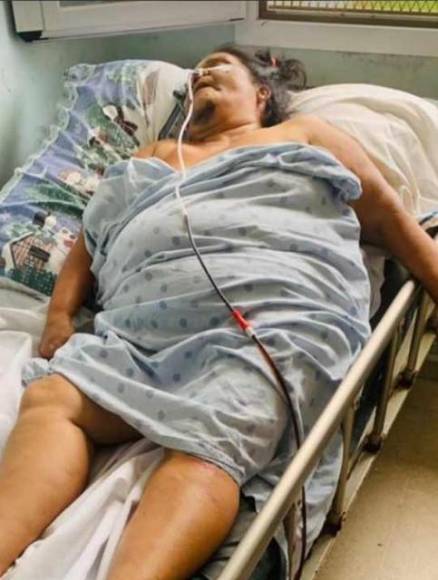 Un hombre la golpeó, maltrató y hasta mató a su madre: los abusos sufridos por la hondureña Lisbany León