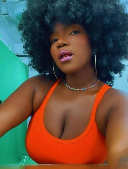 El increíble cambio físico de la Chiky Bombom tras someterse a bypass gástrico