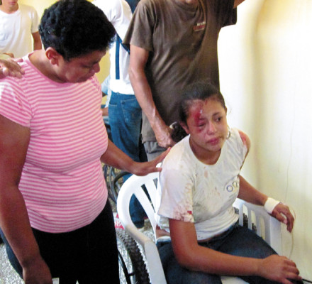 Estudiantes resultan heridos en accidente en La Paz
