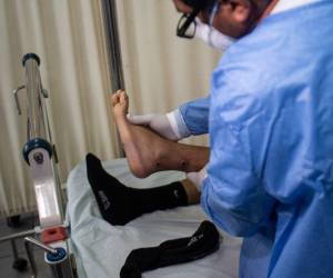 Imagen de referencia de un paciente con viruela del mono.