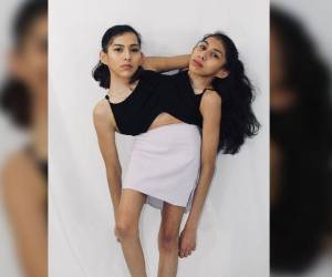 Carmen y Lupita Andrade nacieron con un vínculo de por vida, además de llegar al mundo en el mismo parto, por decisiones de la naturaleza comparten varios órganos de su cuerpo, lo que las obliga a ser inseparables. Esta situación no ha impedido que cada una tome sus propias decisiones, aunque en ocasiones se coloquen en momentos difíciles e incómodos. Así es la vida de las famosas siamesas.