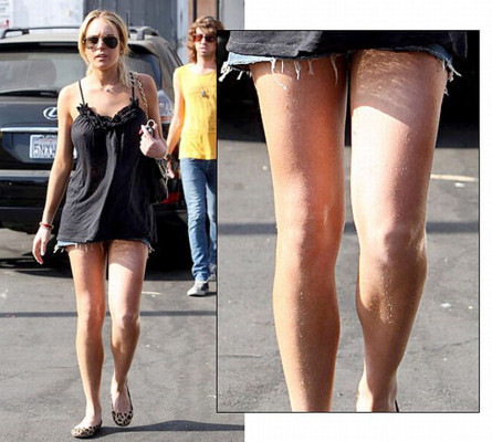 Los descuidos de depilación de las famosas