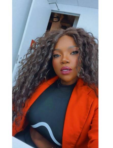 El increíble cambio físico de la Chiky Bombom tras someterse a bypass gástrico