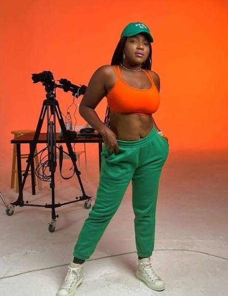 El increíble cambio físico de la Chiky Bombom tras someterse a bypass gástrico