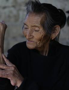 El gusano barrenador no solo ha afectado a casi 700 personas en Centroamérica, sino que ya deja fallecidos. Honduras es el país con más registros de gusano barrenador en personas.