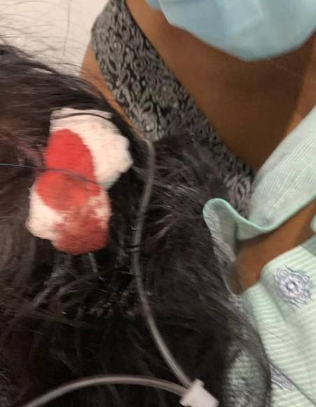 Un hombre la golpeó, maltrató y hasta mató a su madre: los abusos sufridos por la hondureña Lisbany León