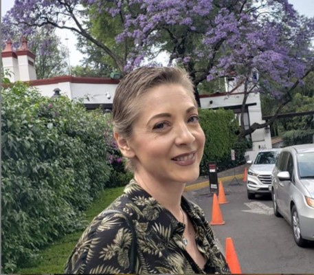 FOTOS: El cambio físico de la actriz Edith González desde que fue diagnosticada con cáncer