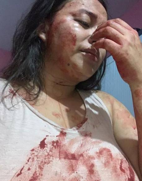 Un hombre la golpeó, maltrató y hasta mató a su madre: los abusos sufridos por la hondureña Lisbany León