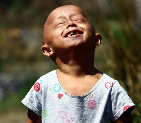 Stefani, una niña atrapada en el cuerpo de una anciana