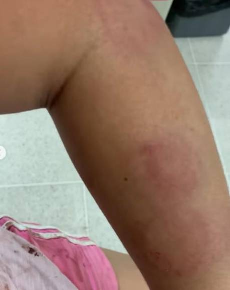 Un hombre la golpeó, maltrató y hasta mató a su madre: los abusos sufridos por la hondureña Lisbany León