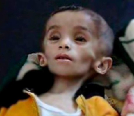 Mueren de hambre 23 personas en la asediada ciudad siria de Madaya