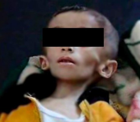 Régimen sirio autoriza el acceso de ayuda humanitaria a ciudad sitiada de Madaya