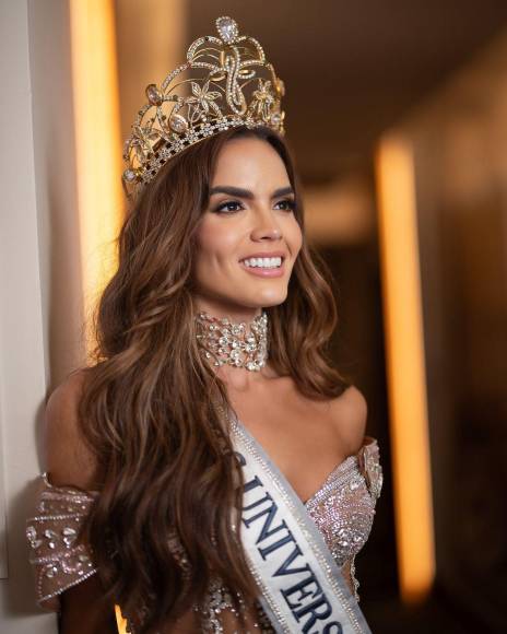 ¿Qué hizo Miss Colombia, Daniela Toloza, para bajar más de 80 libras?