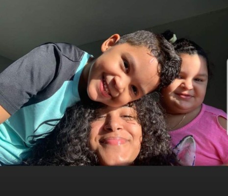 Yanelis Arias, la madre que fue rociada con ácido y murió tras el cruel ataque