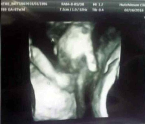 La imagen de dos gemelos tomados de la mano ha conmovido al mundo