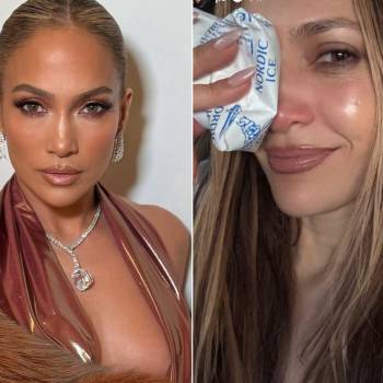 Jennifer López sufre lesión en el rostro tras un accidente en escenario