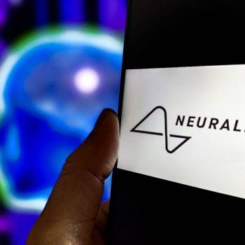 Esta semana se llevó a cabo el primer implante de un chip cerebral en humanos. La empresa de Elon Musk informó que todo se ve prometedor