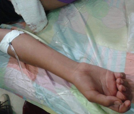 Derrumbe casi acaba con la vida de niña de 10 años