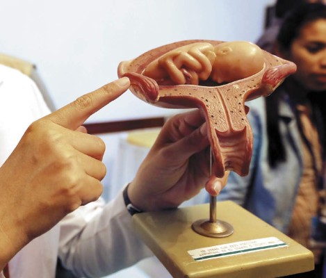 FDA aprobó la PAE en junio de 2013