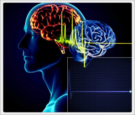 Cómo reacciona nuestro cerebro cuanto presiente la muerte