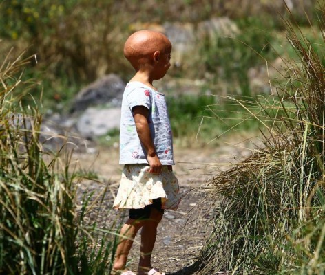 Stefani, una niña atrapada en el cuerpo de una anciana