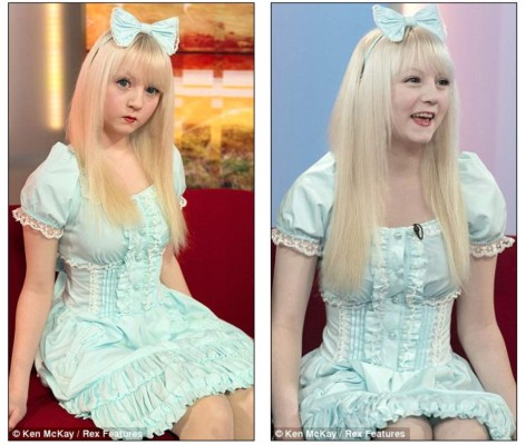 Verdad detrás de las 'barbies humanas'