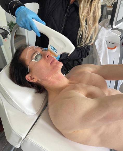 Bryan Johnson, el multimillonario que viajó a Honduras para rejuvenecer