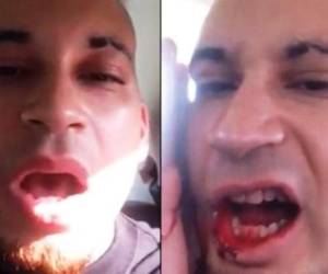 El hombre se disparó en una ocasión en su rostro y luego siguió hablando con normalidad.