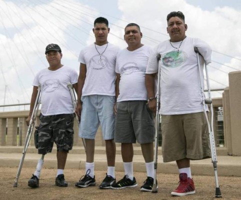 Hondureños amputados cuentan su historia en EE UU