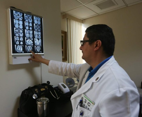 ¿Qué tanto sabe del parkinson?