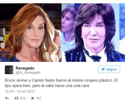 Los memes y las burlas más sonadas por el rostro de Camilo Sesto