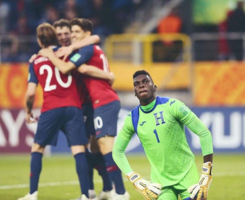 FOTOS: Llanto, tristeza y frustración dejó la paliza 12-0 que recibió Honduras vs Noruega