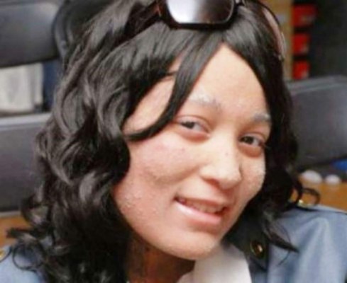 Uñas en vez de pelo