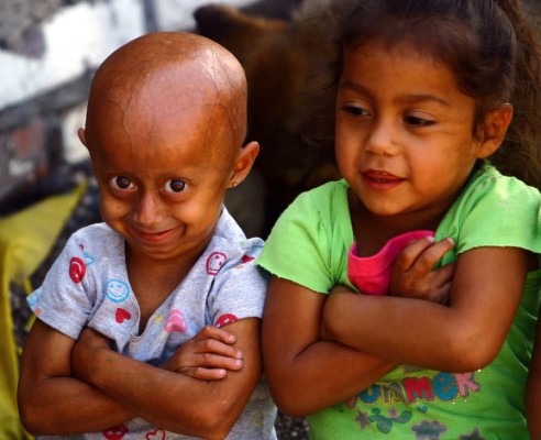 Stefani, una niña atrapada en el cuerpo de una anciana