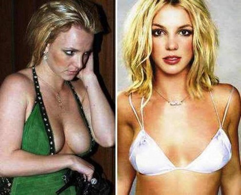 El antes y después de las bubis de las famosas