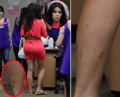 Las imperfecciones que esconden los famosos y que no imaginabas