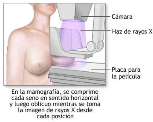 Mujeres pueden esperar hasta los 45 años para hacerse una mamografía