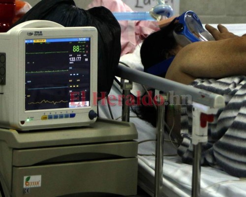 CNA expone irregularidades en compra de 740 ventiladores mecánicos