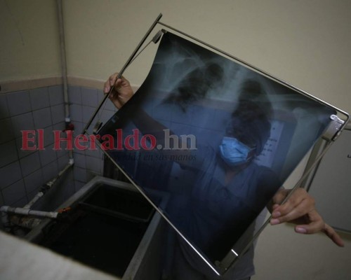 FOTOS: Puro amor y sacrificio, personal de El Tórax lo arriesga todo en la zona covid-19