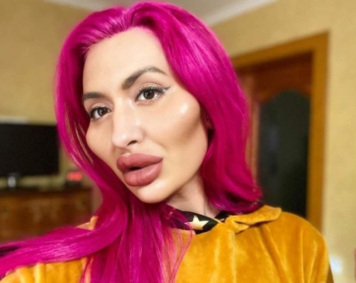 Anastasia Pokreshchuk, la mujer con los pómulos más grandes del mundo (FOTOS)