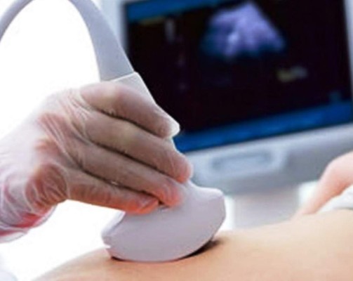 Feminista aborta al saber que tendría un niño