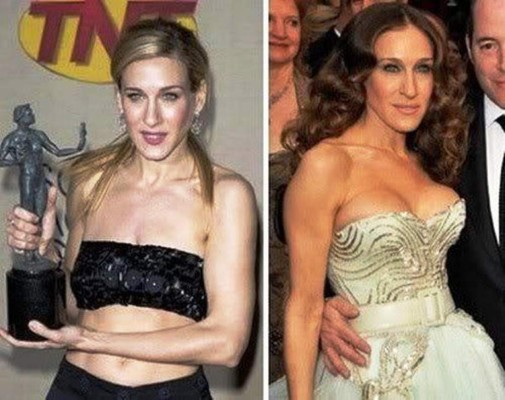 El antes y después de las bubis de las famosas